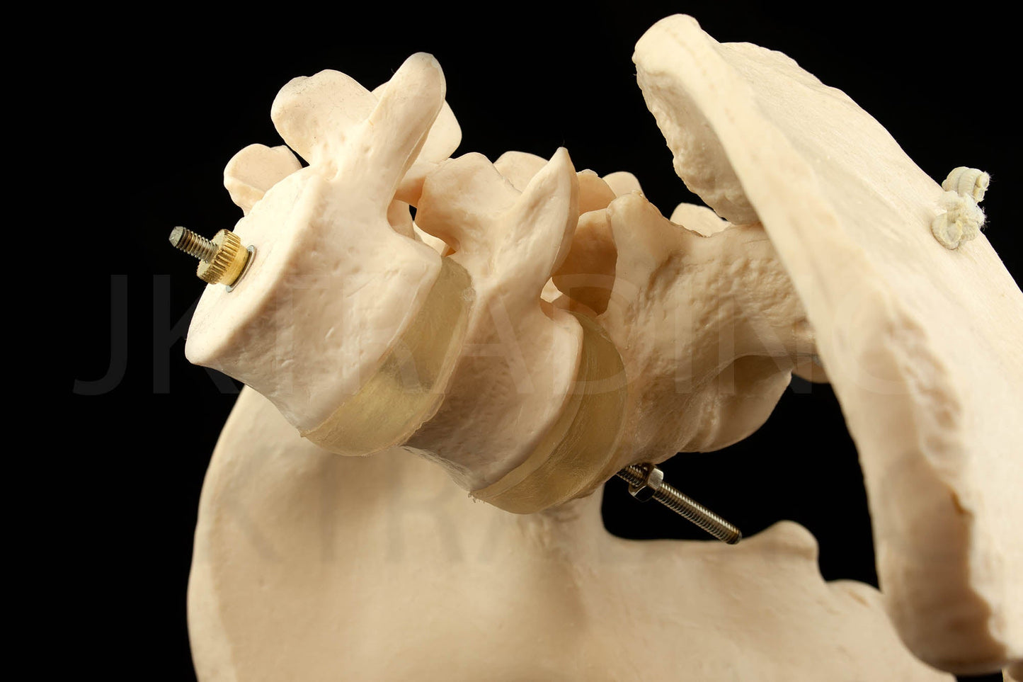 Expandable Female Pelvis Model for medical and anatomy education