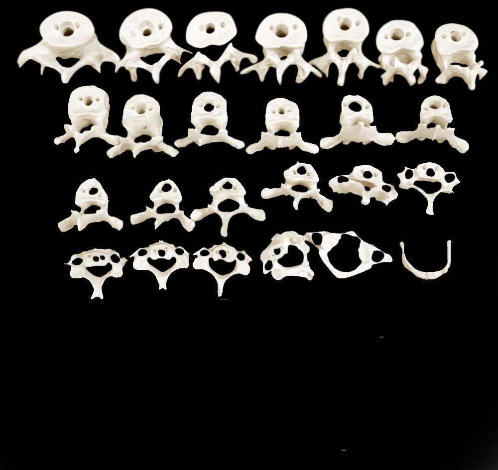 Disarticulated Human Skeleton for medical and anatomy education