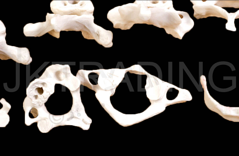 Disarticulated Human Skeleton for medical and anatomy education