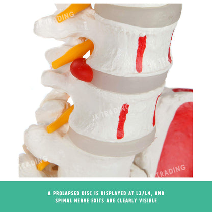 Deluxe Coloured Adult Spine Model with Pelvis & Femur for medical and anatomy education