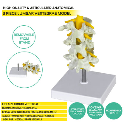 Lumbar Vertebrae & Disc Model – 3 Piece