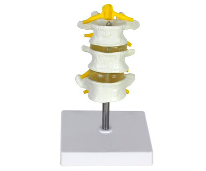 Lumbar Vertebrae & Disc Model – 3 Piece