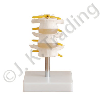 Lumbar Vertebrae & Disc Model for medical and anatomy education